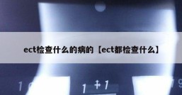 ect检查什么的病的【ect都检查什么】