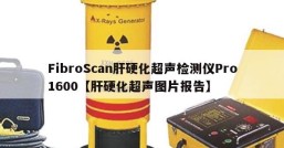 FibroScan肝硬化超声检测仪Pro1600【肝硬化超声图片报告】